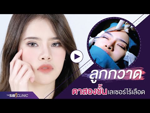 รีวิวตาสองชั้น ชั้นตาสวย ที่ TheSib Clinic