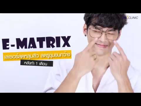 รีวิว Ematrix Laser ลดหลุมสิว กระชับรูขุมขน ที่ The Sib Clinic