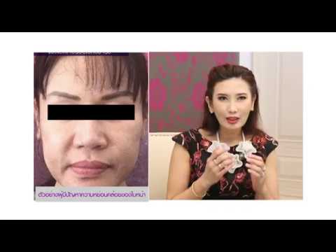 Face Lift ยกกระชับใบหน้า @รายการผู้หญิง.คอม TheSib Clinic