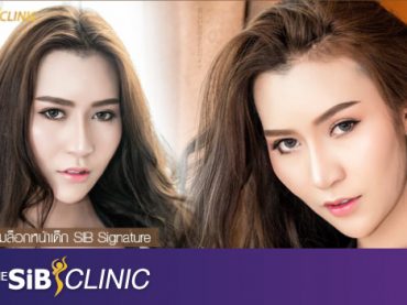 Fb โซเฟียร์ ร้อยไหมsib signature ม.ค. 2018 บอกลาหน้าบาน ด้วยการร้อยไหมหน้า V ยกกระชับปรับรูปหน้า กับคุณหมอดารินทร์