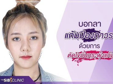 146589 1 ตัดไขมันกระพุ้งแก้ม หน้าเรียวเว่อร์ ที่ The SiB Clinic ค่ะ