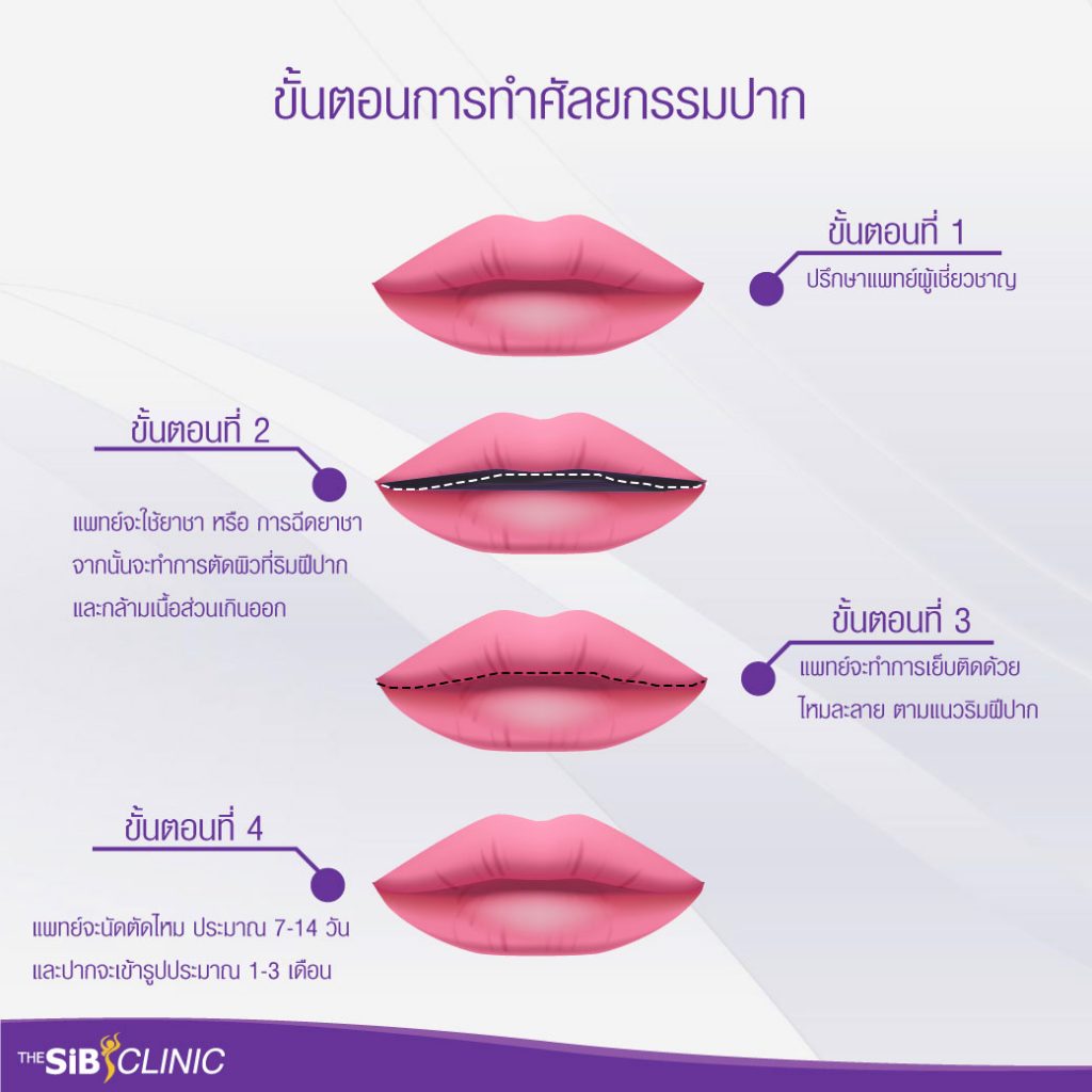 ศัลยกรรมปาก