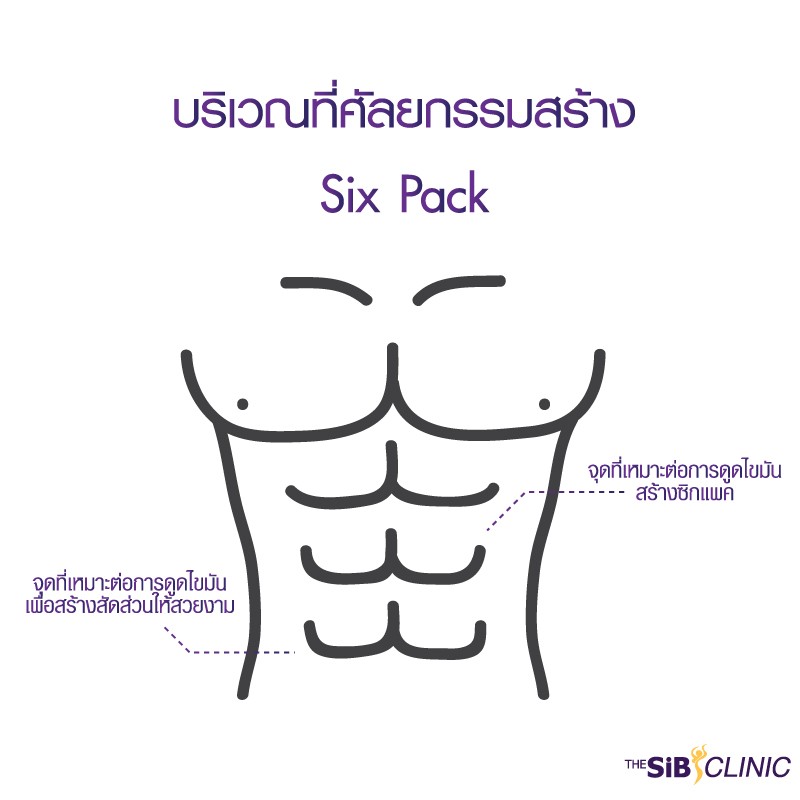 Six pack line