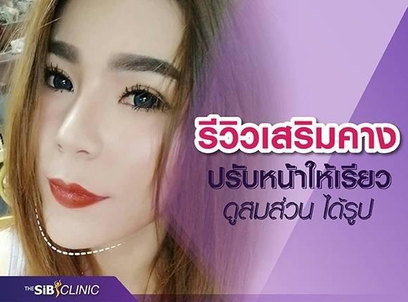 156949 ศัลยกรรมเสริมคาง