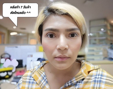 rjug8 ทำตาสองชั้น แบบสาย ฝอ เป๊ะปังตามน้องสาว !! #ทำสวยไปด้วยกัน ที่ The SiB Clinic