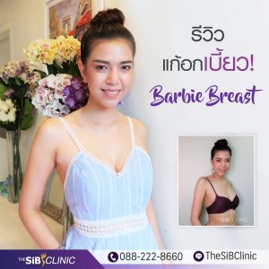 4 เสริมหน้าอก Barbie Breast  กับคุณหมอดารินทร์