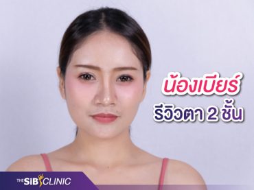 รีวิว ตา 2 ชั้น น้องเบียร์ ชั้นตาสวยมั่นใจเกิน 100 ชีวิตดี๊ดีไปอีก