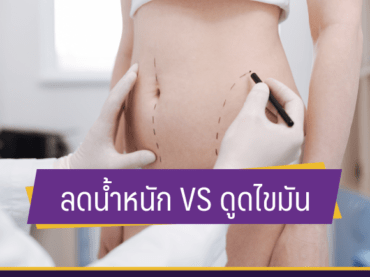 06 Liposuction and exercise 291118 05 ดูดไขมัน VS ลดน้ำหนัก