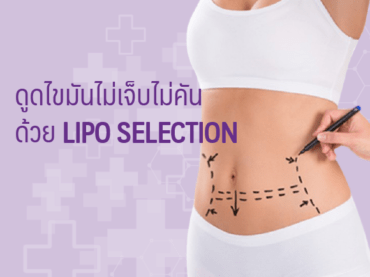 Cover ดูดไขมันไม่เจ็บไม่คันด้วย Lipo Selection