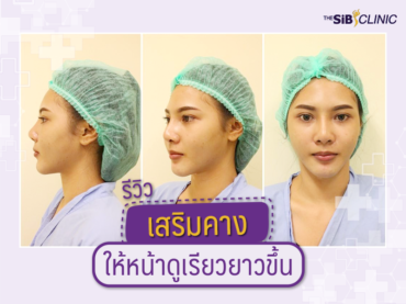 1 รีวิวเสริมคาง ให้หน้าเรียวยาวขึ้น