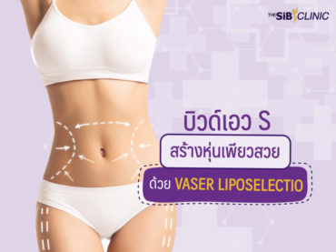 03 บิวด์เอว S สร้างหุ่นเพียวสวยด้วย Vaser Liposelection