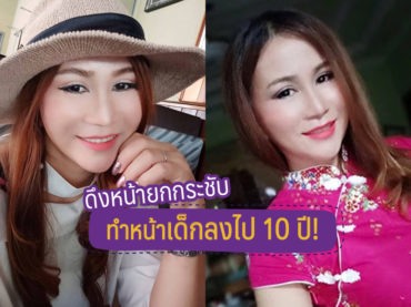 5 ดึงหน้ายกกระชับ ทำหน้าเด็กลงไป 10 ปี!