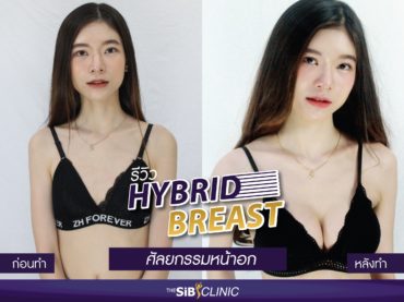 cover 02 รีวิวเสริมหน้าอก HYBRID BREAST คุณพลอย