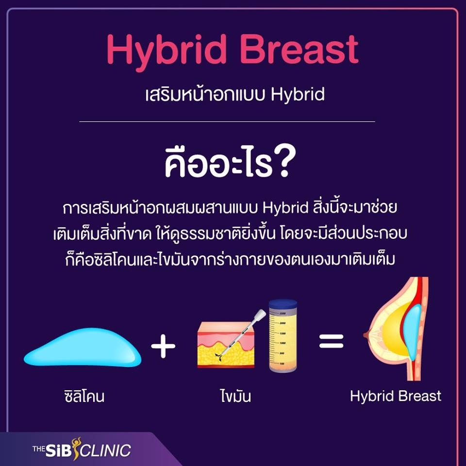 ทำหน้าอก hybrid Breast เดอะซิบ คลินิก 3 ศัลยกรรมเสริมหน้าอก เทคนิค Hybrid Breast ที่ เดอะซิบส์ คลินิก