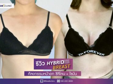 ทำหน้าอก เดอะซิบส์ คลินิก คุณเป๋ง 3 รีวิว เสริมหน้าอกจากคัพเอ สู่คัพซี จากคุณแม่ลูกสองแต่อยากแซ่บ!!!