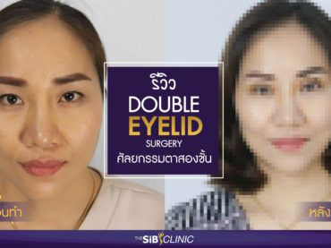 11 รีวิว หนังตาหย่อนมาจากไหน ก็แก้ไขได้ง่าย ๆ ที่ The Sib Clinic