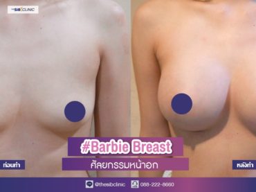 ทำหน้าอก เดอะซิบส์ คลินิก คุณวีวี่ 8 รีวิว อัพเดตเสริมหน้าอกทรง Barbie Breast หลังทำ 2 เดือน ที่ เดอะซิบส์ คลินิก จะสวยแค่ไหนไปดูกันเลยย