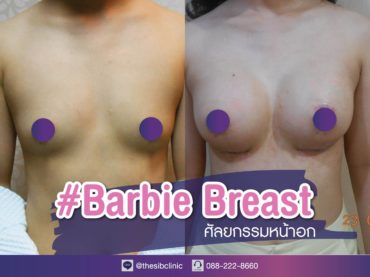 ทำหน้าอก เดอะซิบส์ คลินิก คุณเอม1 รีวิว แชร์ประสบการณ์ เสริมหน้าอก ทรง Barbie Breast ที่ เดอะซิบส์ คลินิก