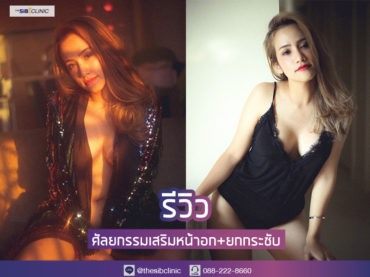 2 1 แก้หน้าอกหย่อนคล้อยหลังคลอด ผลลัพธ์ปังมาก!