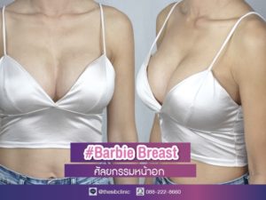 ทำหน้าอก ทำนม Barbie Breast เดอะซิบส์ คลินิก คุณชล 1 เสริมหน้าอก Barbie Breast อกชิดเนินชัด ทรงสวยแบบบาร์บี้