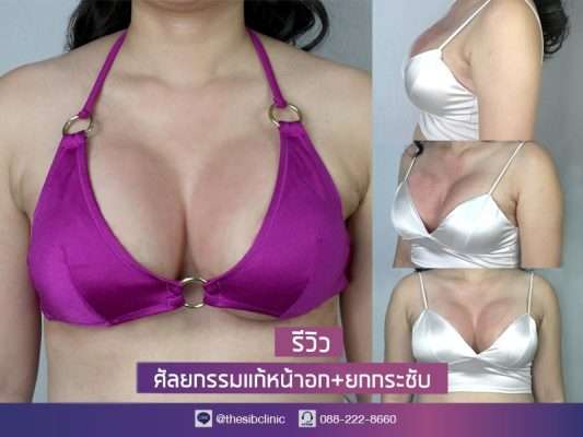 คำถามยกกระชับหน้าอก