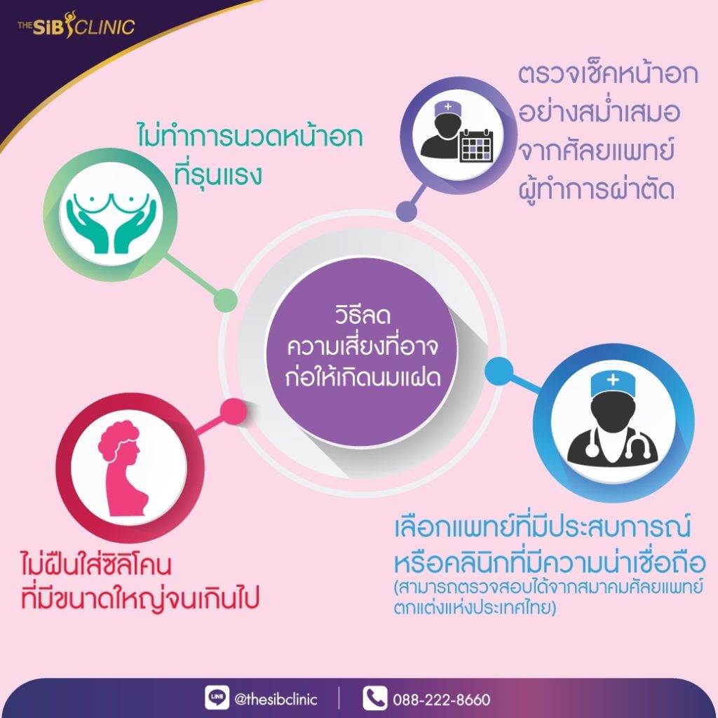 ทำหน้าอก เดอะซิบส์ คลินิก นมแฝด 9 ภาวะนมแฝด คืออะไร? (Symmastia)