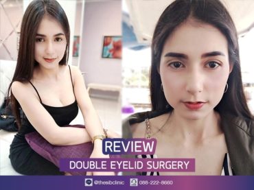 รีวิว ทำตาสองชั้น ตาสองชั้นสวย ตาสองชั้นที่ไหนดี เดอะซิบส์ คลินิก คุณบี