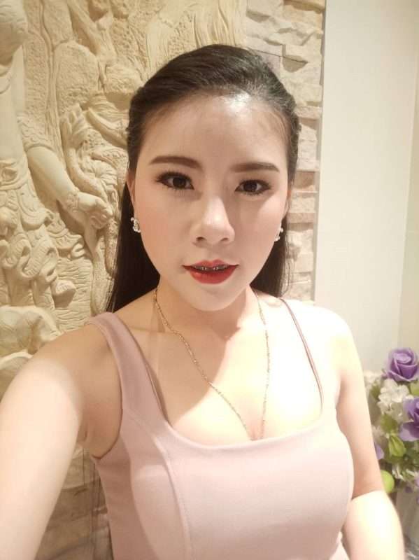 เสริมคาง+ตัดไขมันกระพุ้งแก้ม