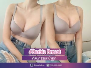 เสริมหน้าอก Barbie Breast