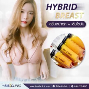 3 เสริมหน้าอกHybrid Breast