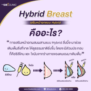 hybrid breast คืออะไร เสริมหน้าอกHybrid Breast