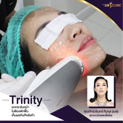 TRINITY เลเซอร์ทรีนิตี้ | ลดเลือนฝ้า กระ จุดด่างดำ