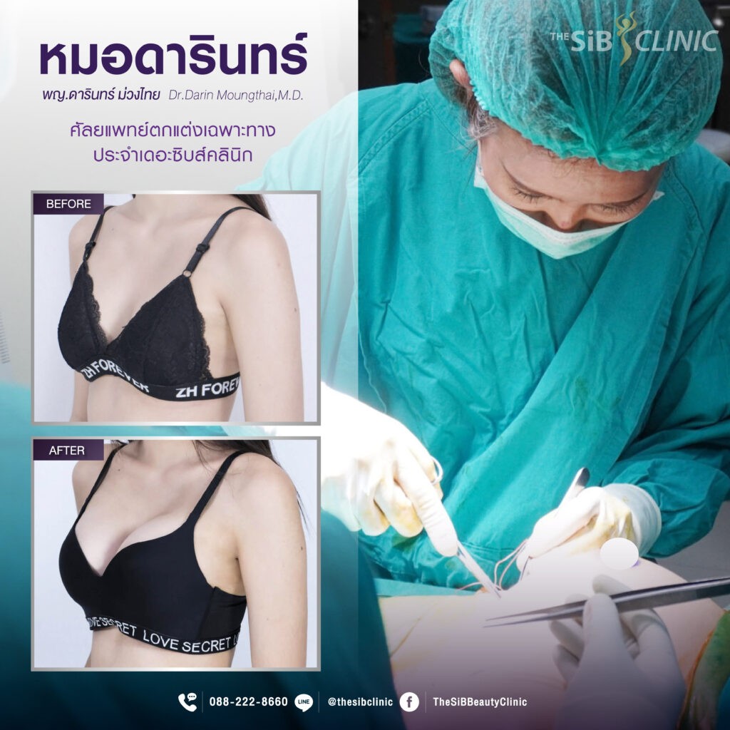 ADหมอ 01 1 เสริมหน้าอกแบบ Hybrid Breast