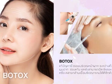 BOTOX Botox