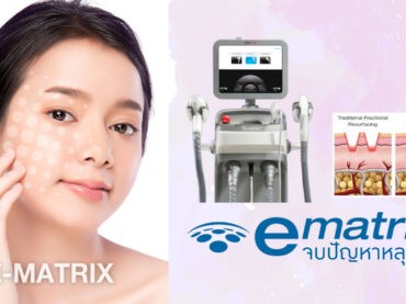 EMATRIX E-Matrix