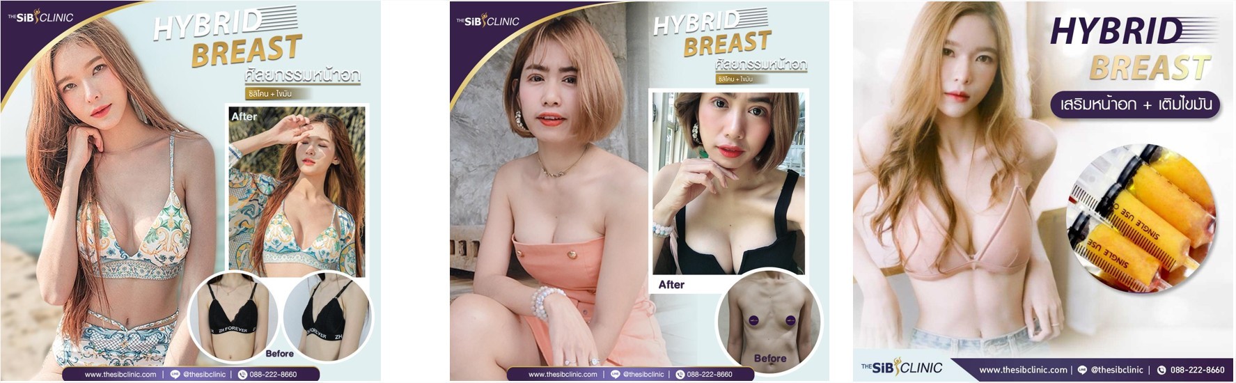 Hybrid Breast Word 1 เสริมหน้าอก Hybrid breast