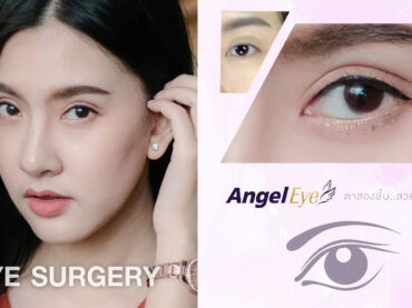 ศัลยกรรมตา EYE SURGERY