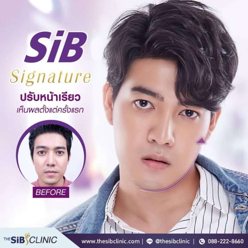 ดึงหน้า vs ร้อยไหม