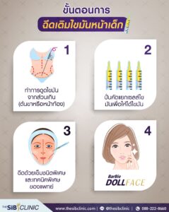 6 รีวิวเติมไขมันหน้าเด็ก