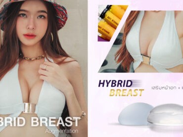 HYBRIDBREAST เสริมหน้าอกแบบ Hybrid Breast