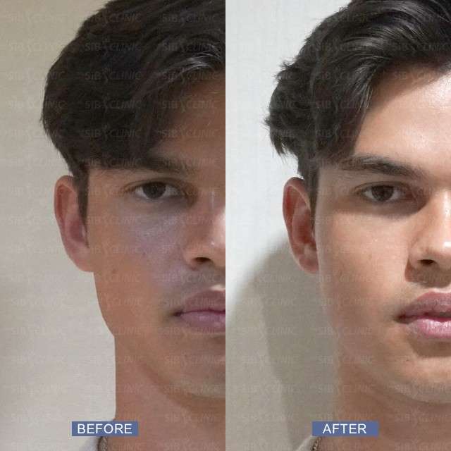 รีวิว Trinity ยกกระชับแบบมืออาชีพ ให้คุณมั่นใจได้ทุกวัน!