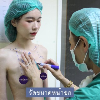 word image 59 รีวิวเสริมหน้าอก เติมไขมัน คุณพลอย ที่ The SIB Clinic