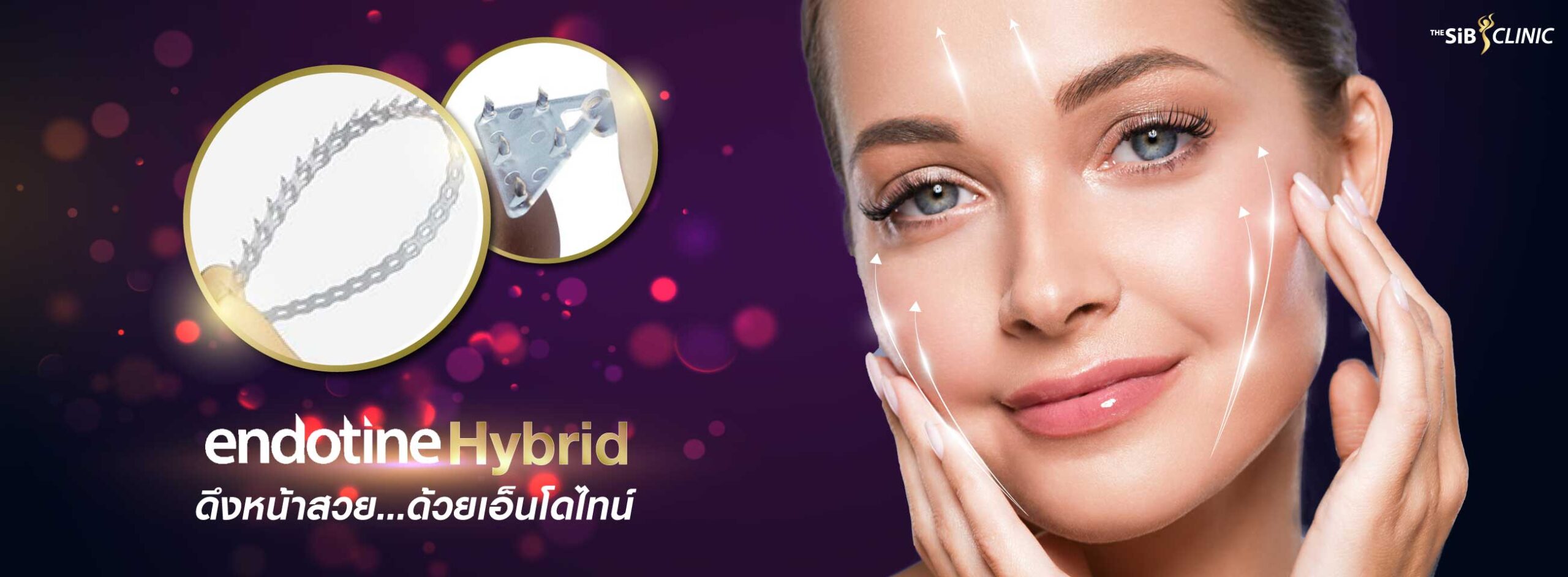 Endotine Facelift – The SIB Plastic Surgery