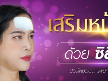 COVERเสริมหน้าผาก 02 รีวิวเสริมหน้าผาก