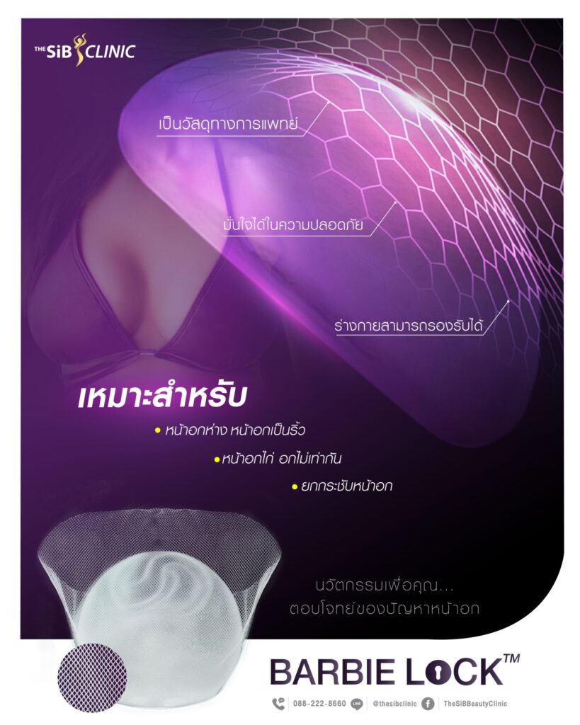 01 1 นมเป็นคลื่นริ้ว (Rippling)