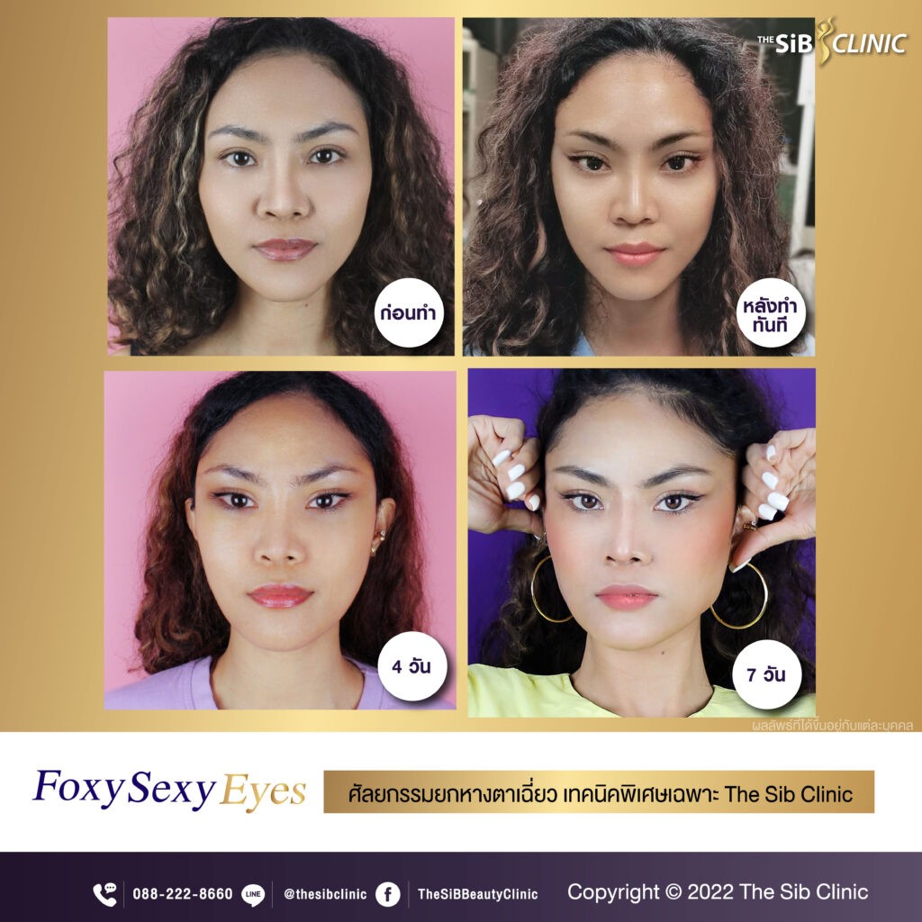 Foxy Sexy Eyes ยกหางตาเฉี่ยว แก้หางตาตก