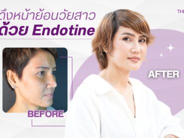 LINE ALBUM 230410 0 ดึงหน้า minifacelict endotine ย้อนวัยอีกครั้ง