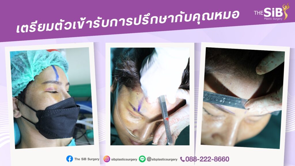 LINE ALBUM 230410 1 ดึงหน้า minifacelict endotine ย้อนวัยอีกครั้ง