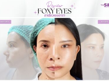 LINE ALBUM 230519 17 FOXY EYES  เปลี่ยนหมวยซิ่มเป็นหมวยอินเตอร์