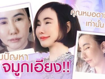 S 23748694 1 บอกลาจมูกเอียง 9 ปี มาจบที่หมอดารินทร์